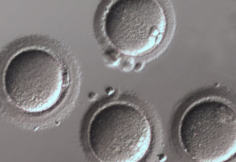 Fertilité : les clés pour améliorer la qualité des ovocytes